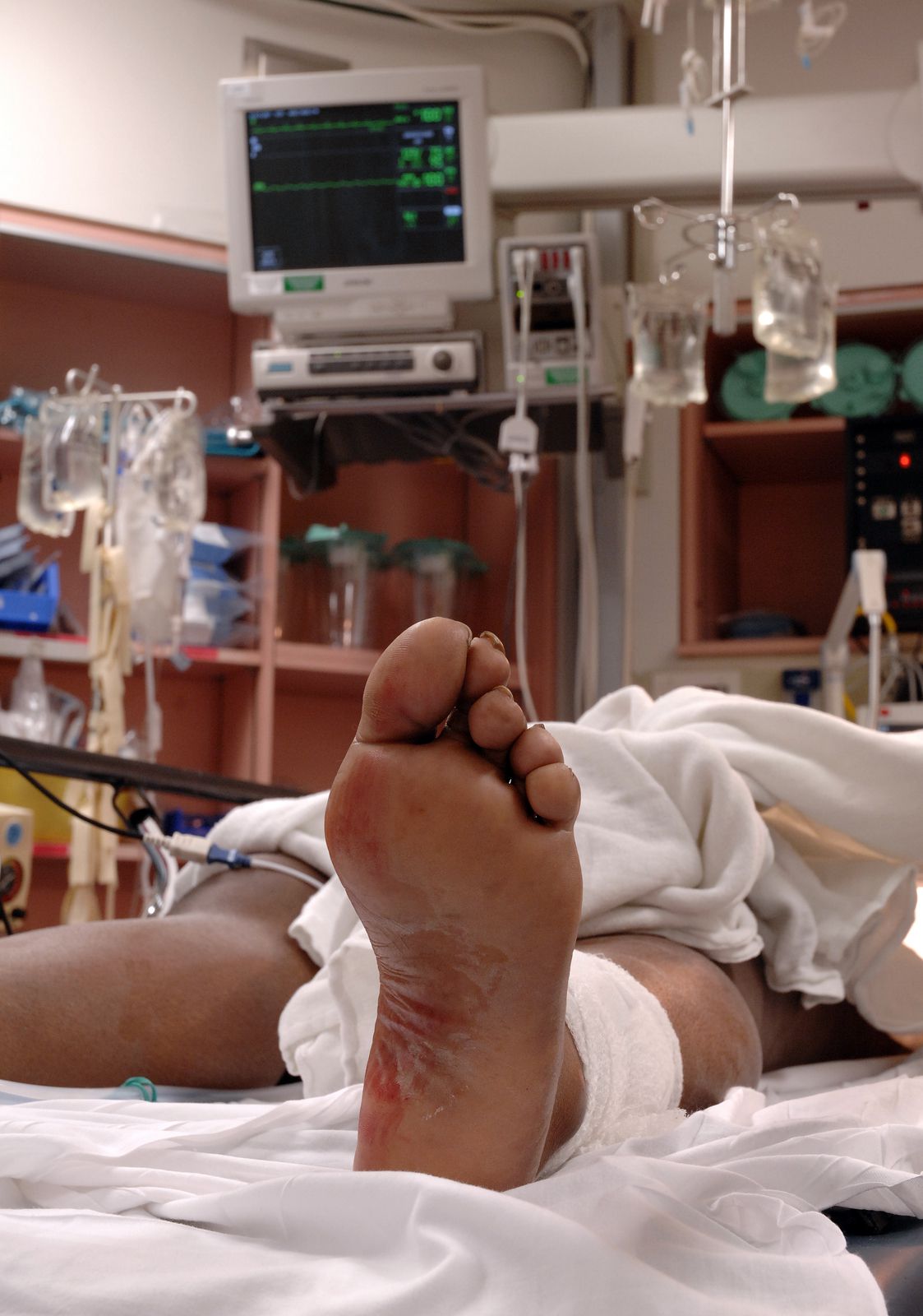 Personal Injury